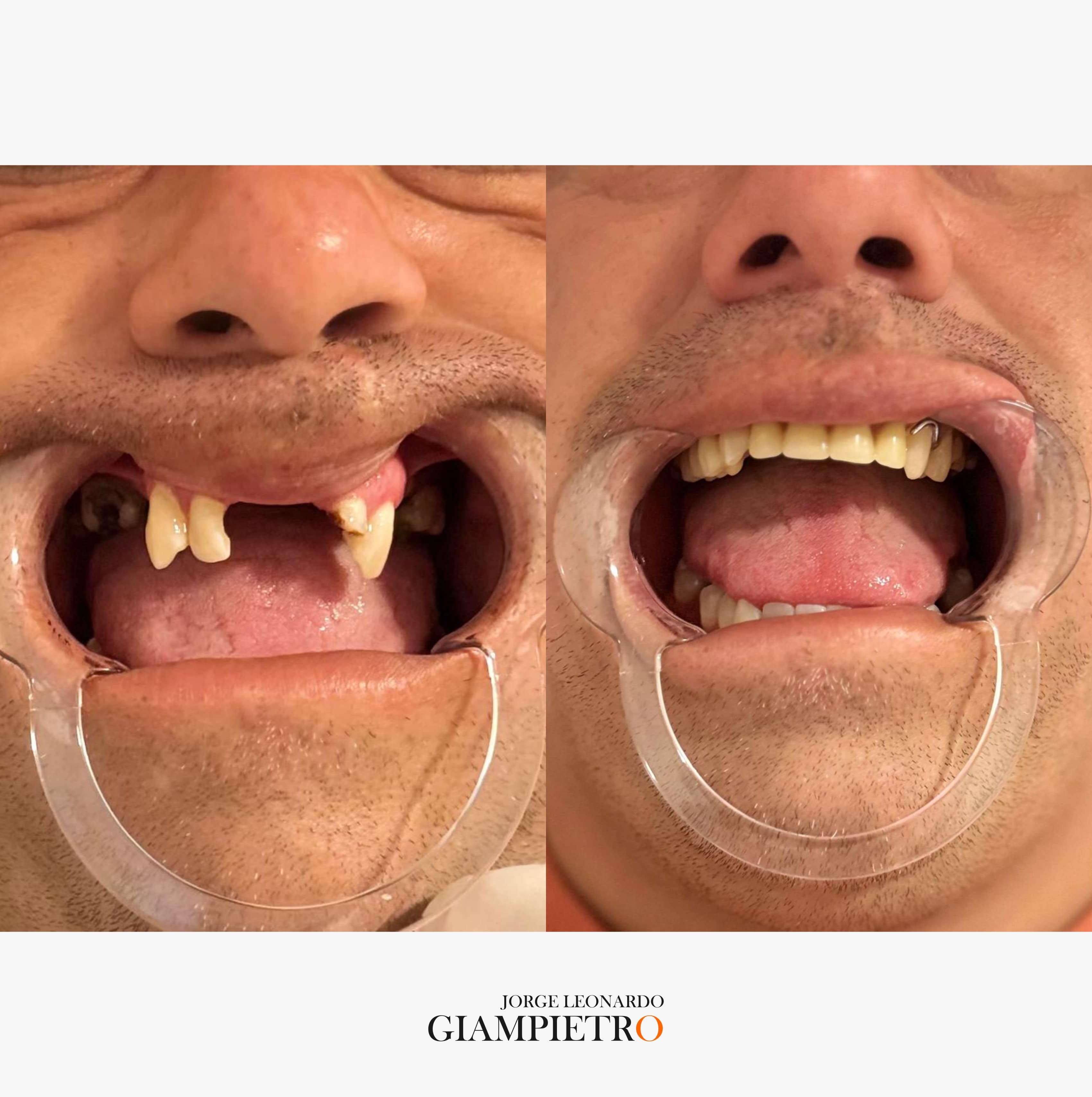 Diseño de Sonrisa
