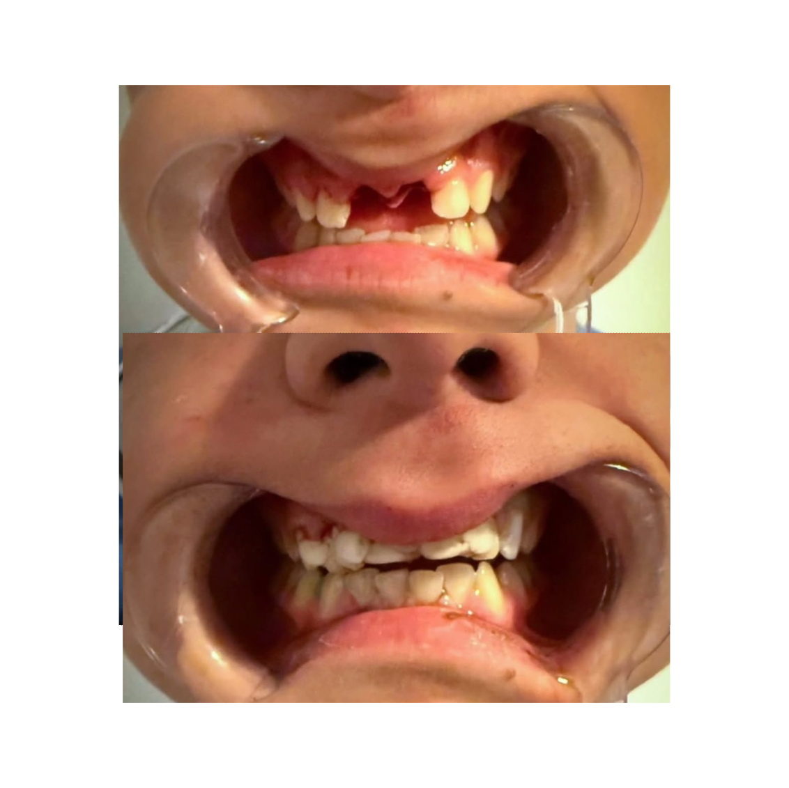 Reconstrucción Estética